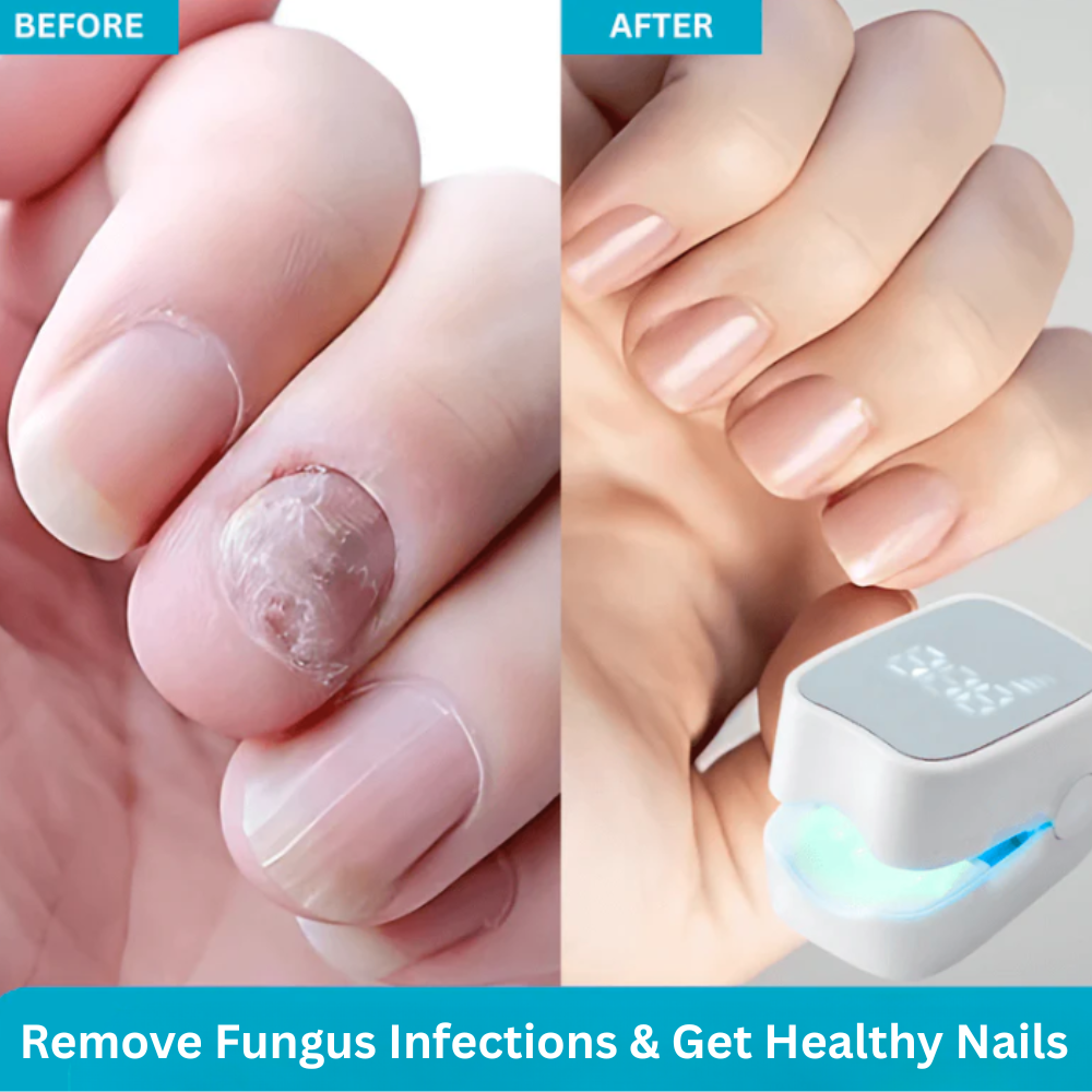 NailPro Fungus Remover