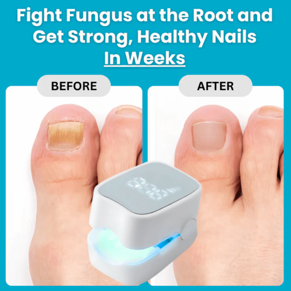 NailPro Fungus Remover