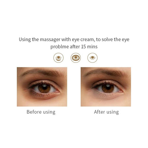 CalmEye Electric Massager